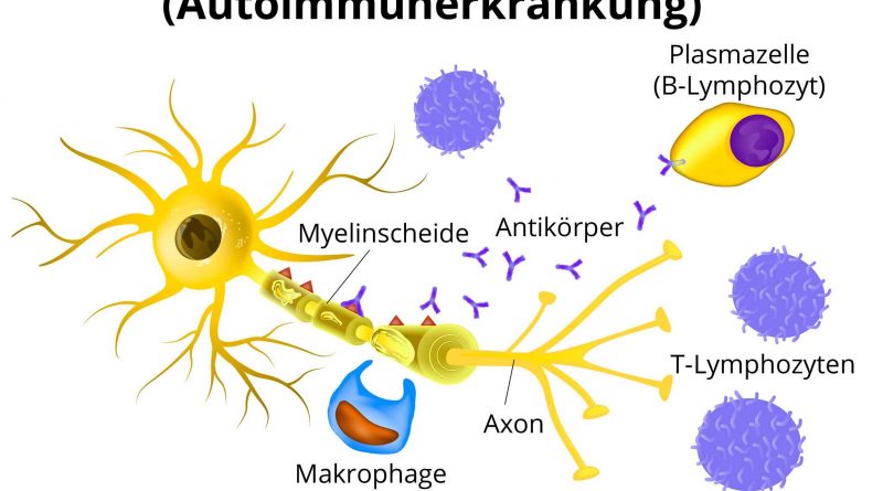 Welche Auswirkungen hat eine alkalische Diät auf Multiple Sklerose?